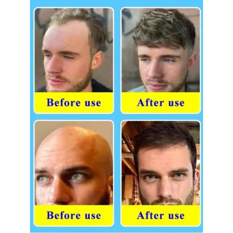 Biotin Kolajen Saç Bakım Yağı, - Hair Care Collagen incelemesi ve fiyatı