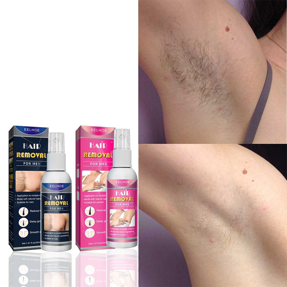 1/2 adet süper doğal ağrısız k - Hair Care Women incelemesi ve fiyatı